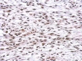 Anti-CBX1 / HP1 beta antibody used in IHC (Paraffin sections) (IHC-P). GTX106418