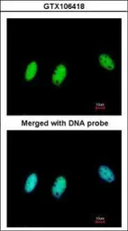 Anti-CBX1 / HP1 beta antibody used in Immunocytochemistry/ Immunofluorescence (ICC/IF). GTX106418