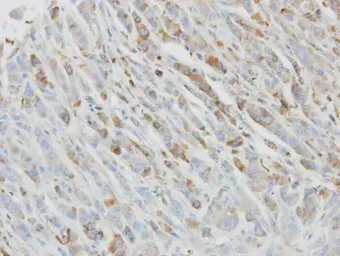 Anti-IL1 Receptor antagonist antibody used in IHC (Paraffin sections) (IHC-P). GTX106490