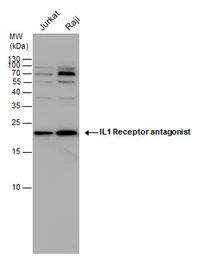 Anti-IL1 Receptor antagonist antibody used in Western Blot (WB). GTX106490