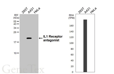 Anti-IL1 Receptor antagonist antibody used in Western Blot (WB). GTX106490