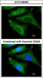 Anti-IL1 Receptor antagonist antibody used in Immunocytochemistry/ Immunofluorescence (ICC/IF). GTX106490