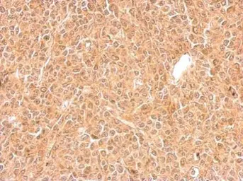 Anti-GGPS1 antibody used in IHC (Paraffin sections) (IHC-P). GTX106493