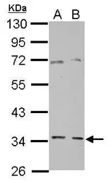 Anti-GGPS1 antibody used in Western Blot (WB). GTX106493