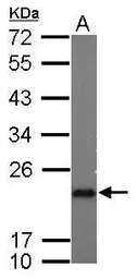 Anti-p23 antibody [N1C3] used in Western Blot (WB). GTX106550