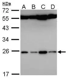 Anti-FAM9B antibody [N1C3] used in Western Blot (WB). GTX106630