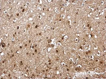 Anti-SKP1 antibody used in IHC (Paraffin sections) (IHC-P). GTX106675