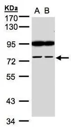 Anti-FSD2 antibody [N1N2], N-term used in Western Blot (WB). GTX106809