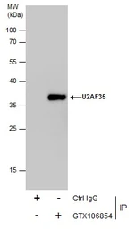 Anti-U2AF35 antibody used in Immunoprecipitation (IP). GTX106854