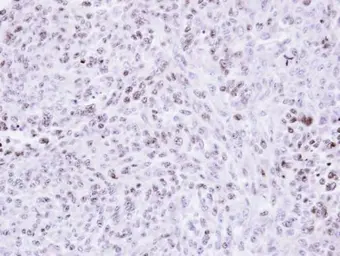 Anti-ZNF707 antibody [N2C3] used in IHC (Paraffin sections) (IHC-P). GTX106928