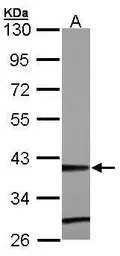 Anti-ZNF707 antibody [N2C3] used in Western Blot (WB). GTX106928