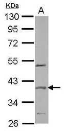 Anti-SPOP antibody [N1C1] used in Western Blot (WB). GTX106942