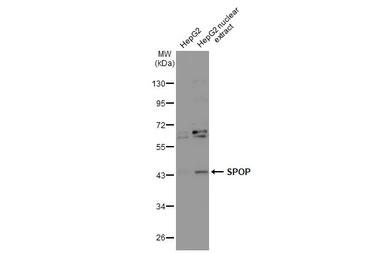 Anti-SPOP antibody [N1C1] used in Western Blot (WB). GTX106942