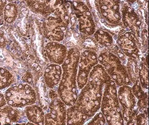 Anti-BZW2 antibody used in IHC (Paraffin sections) (IHC-P). GTX106985