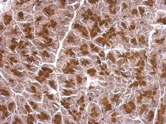 Anti-BZW2 antibody used in IHC (Paraffin sections) (IHC-P). GTX106985