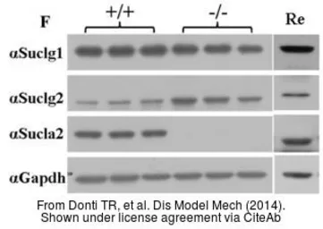 Anti-SUCLG2 antibody used in Western Blot (WB). GTX107002