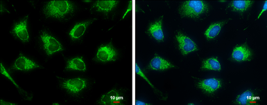 Anti-SUCLG2 antibody used in Immunocytochemistry/ Immunofluorescence (ICC/IF). GTX107002