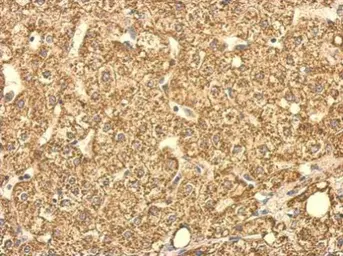 Anti-SUCLG2 antibody used in IHC (Paraffin sections) (IHC-P). GTX107002