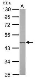 Anti-SUCLG2 antibody used in Western Blot (WB). GTX107002