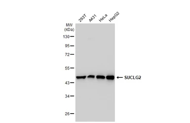 Anti-SUCLG2 antibody used in Western Blot (WB). GTX107002