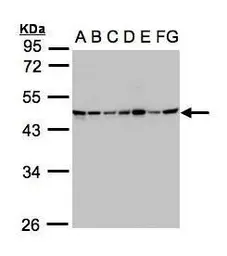 Anti-SUCLG2 antibody used in Western Blot (WB). GTX107002