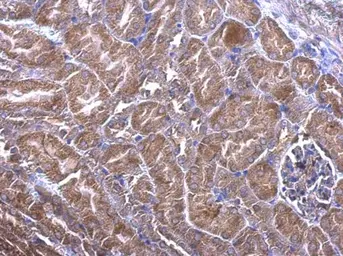 Anti-PHLP antibody used in IHC (Paraffin sections) (IHC-P). GTX107089