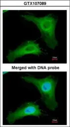 Anti-PHLP antibody used in Immunocytochemistry/ Immunofluorescence (ICC/IF). GTX107089