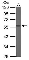 Anti-RGMB antibody [N3C3] used in Western Blot (WB). GTX107091