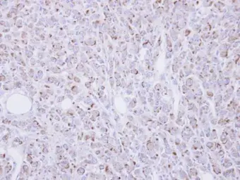 Anti-RGMB antibody [N3C3] used in IHC (Paraffin sections) (IHC-P). GTX107091