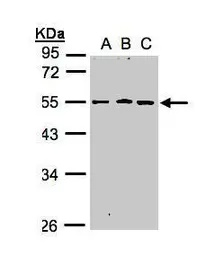 Anti-RGMB antibody [N3C3] used in Western Blot (WB). GTX107091