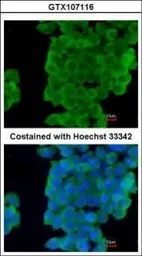 Anti-LXN antibody [N1C3] used in Immunocytochemistry/ Immunofluorescence (ICC/IF). GTX107116