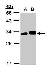 Anti-LXN antibody [N1C3] used in Western Blot (WB). GTX107116