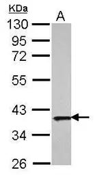 Anti-APE1 antibody used in Western Blot (WB). GTX107122