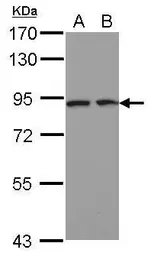 Anti-DCBLD2 antibody used in Western Blot (WB). GTX107215