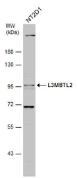 Anti-L3MBTL2 antibody used in Western Blot (WB). GTX107234