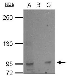 Anti-L3MBTL2 antibody used in Immunoprecipitation (IP). GTX107234