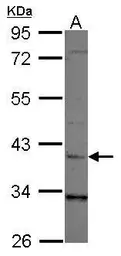 Anti-LRG1 antibody [N1C3] used in Western Blot (WB). GTX107355