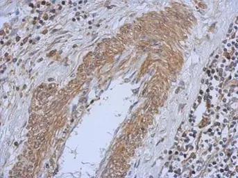 Anti-PI4 kinase alpha antibody [C1C2], Internal used in IHC (Paraffin sections) (IHC-P). GTX107441