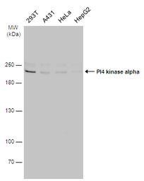 Anti-PI4 kinase alpha antibody [C1C2], Internal used in Western Blot (WB). GTX107441