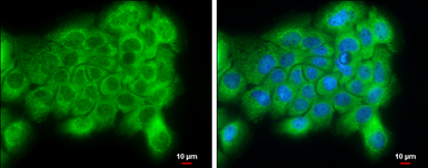 Anti-PI4 kinase alpha antibody [C1C2], Internal used in Immunocytochemistry/ Immunofluorescence (ICC/IF). GTX107441