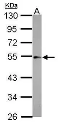 Anti-ILK antibody [N1C1-2] used in Western Blot (WB). GTX107443