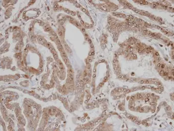 Anti-CaMKI delta antibody [N1C1] used in IHC (Paraffin sections) (IHC-P). GTX107490