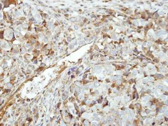 Anti-GK5 antibody used in IHC (Paraffin sections) (IHC-P). GTX107498