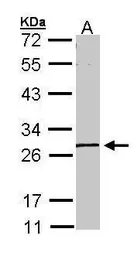 Anti-GK5 antibody used in Western Blot (WB). GTX107498