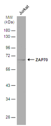 Anti-ZAP70 antibody used in Western Blot (WB). GTX107537