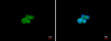 Anti-ZAP70 antibody used in Immunocytochemistry/ Immunofluorescence (ICC/IF). GTX107537