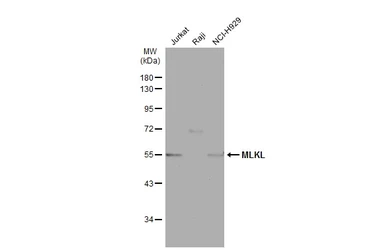 Anti-MLKL antibody used in Western Blot (WB). GTX107538