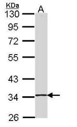 Anti-SKAP55 antibody [N1C3-2] used in Western Blot (WB). GTX107560