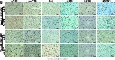 Anti-p70 S6K antibody used in IHC (Paraffin sections) (IHC-P). GTX107562