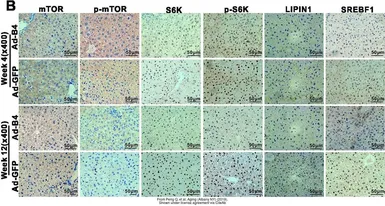 Anti-p70 S6K antibody used in IHC (Paraffin sections) (IHC-P). GTX107562